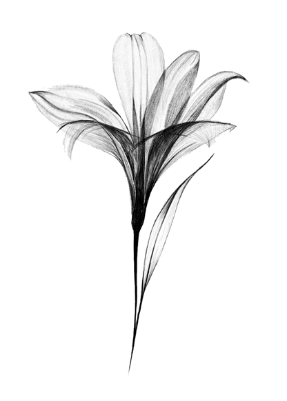 X-ray Lily Print